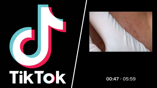 TikTok 6-minute videos